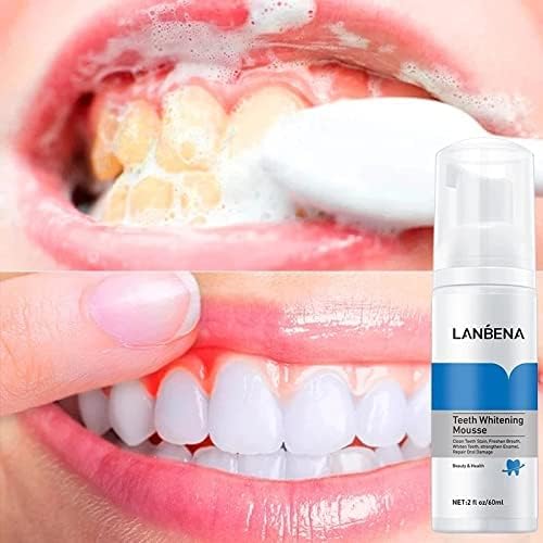 Lanbena Diatech Lanbena Teeth Whitening Mousse (60ml)