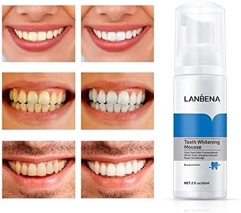 Lanbena Diatech Lanbena Teeth Whitening Mousse (60ml)